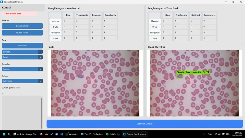 Screenshot of malaria parasite detection bounding boxes