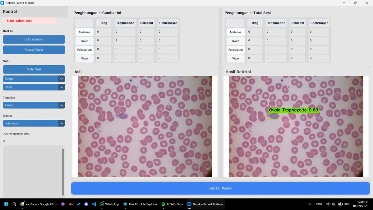 Screenshot of malaria parasite detection bounding boxes